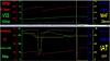 Manic Motorsport brings us N18 owners OBD II Tuning! Solution is finally here!-map-c.jpg